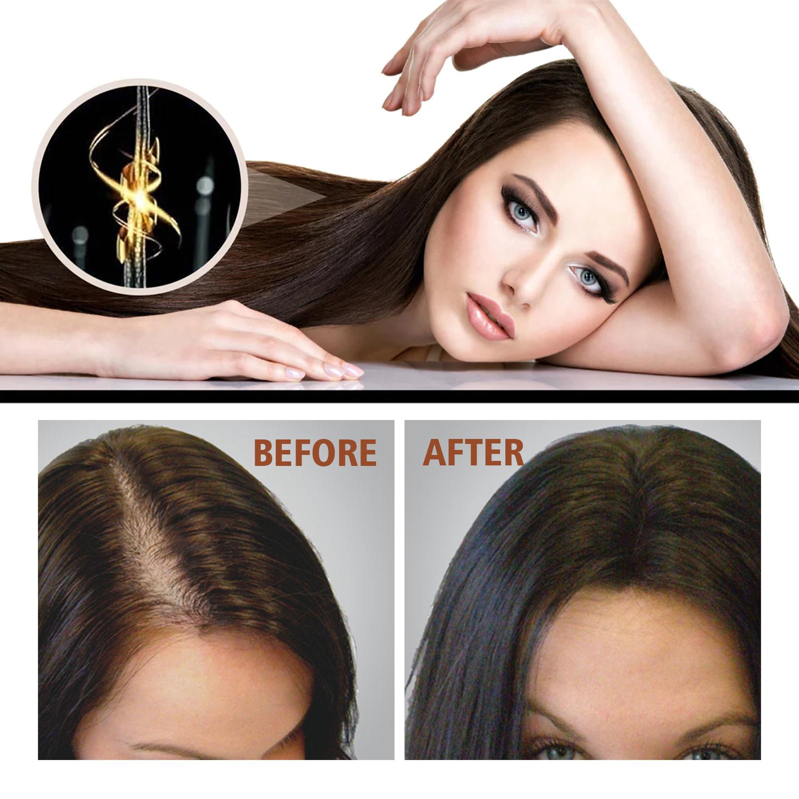 Batana Oil From Honduras - Get Fuller, Thicker, Healthier Hair - Great Gifts For Women Men Conditioner Haircare Silky - Hair Nutrition - 5 - CJ
