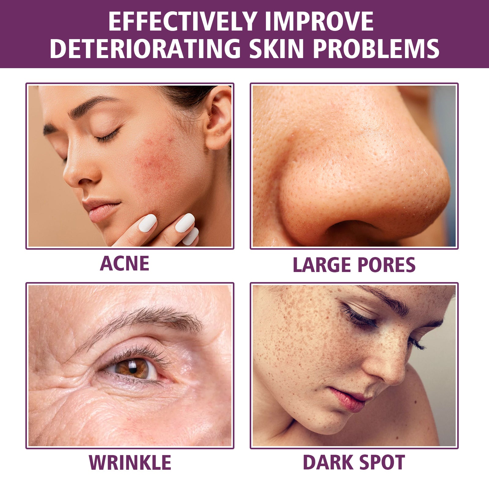 EELHOE Niacinamide Serum, Skincare Lifting Spot - Blemishing And Anti - Wrinkle Serum - 5 - CJ