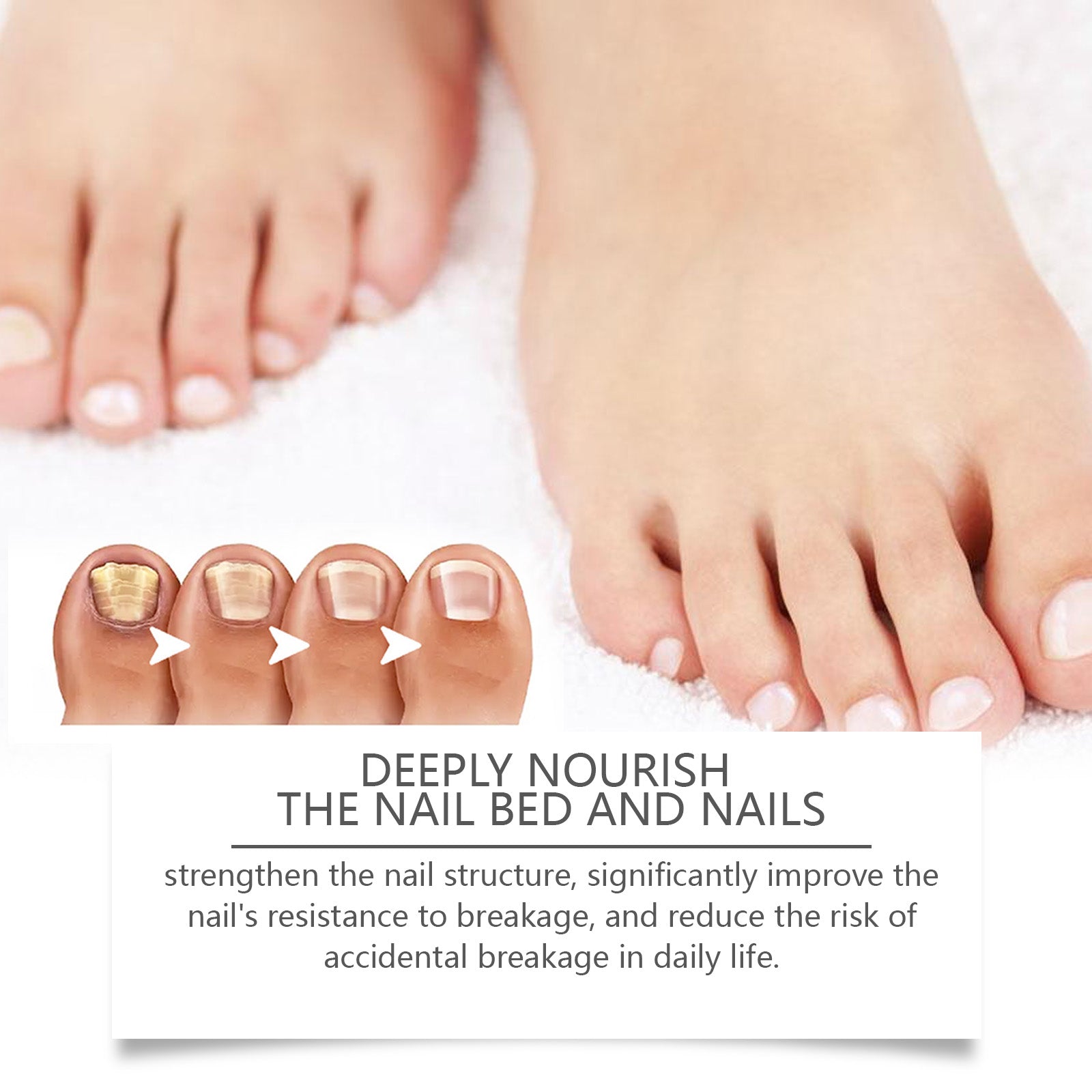 West&Month Nail Repair Solution, Hand And Foot Nail Cleaning Care Gentle Moisturizing And Moisturizing Nail Repair Solution - 5 - CJ