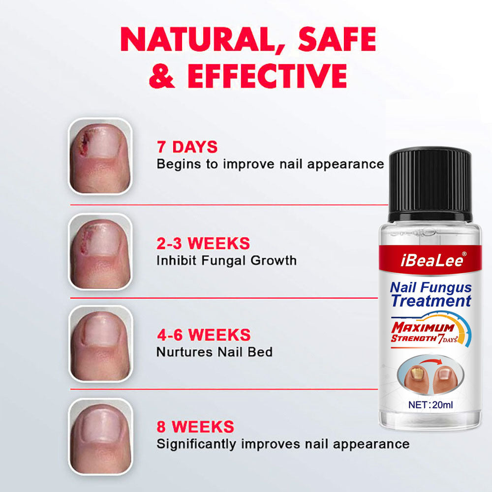 Thickening Of Special Bacteriostatic Liquid For Onychomycosis - 0 - CJ