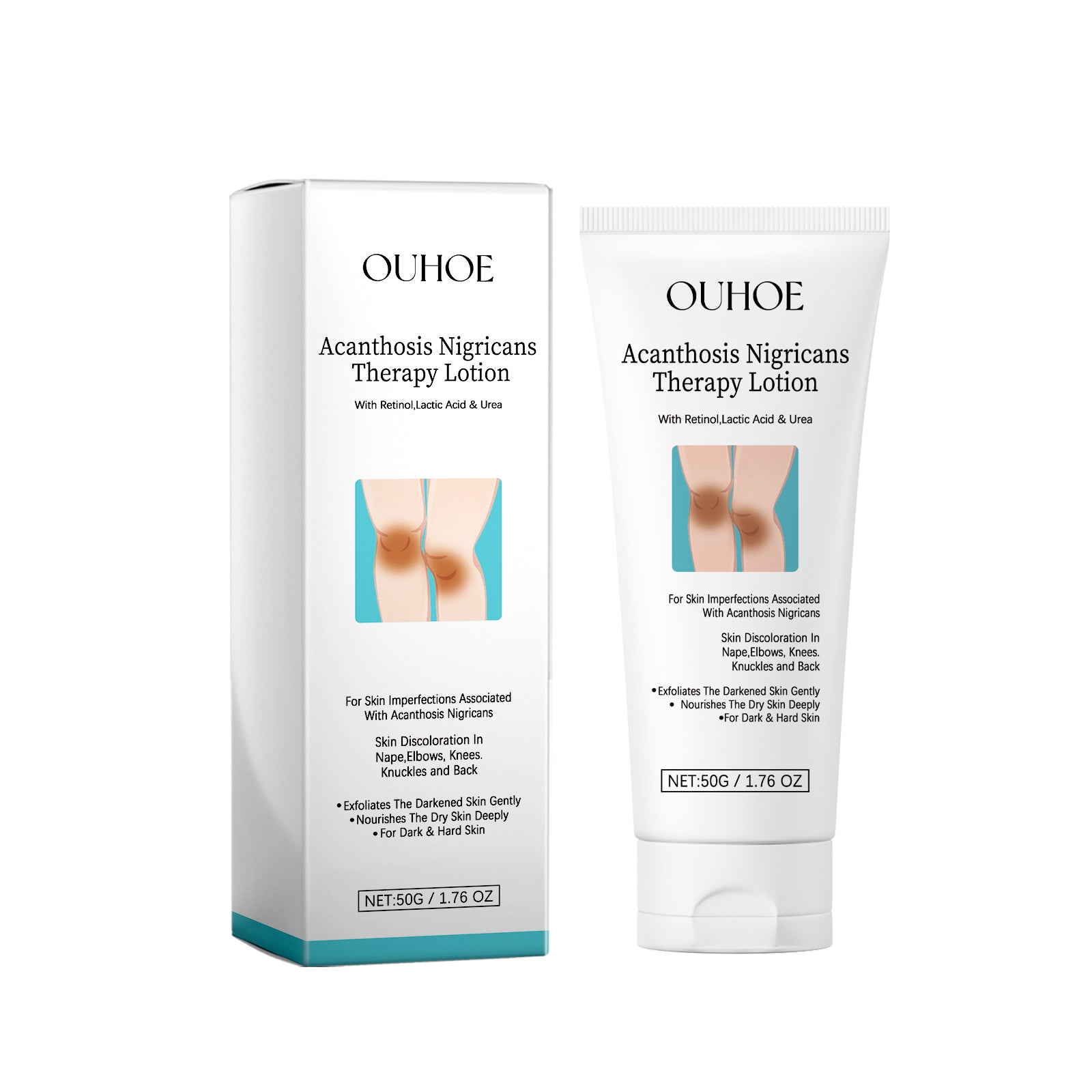 OUHOE Acanthosis Nigricans Therapy Lotion, Skin Moisturizing Clean Black Dark Heavy Alar Knee Joint Repair Carry Bright Color Of Skin - 5 - CJ