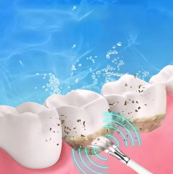 Smart Ultra - Sonic Teeth Cleaner - 5 - CJ