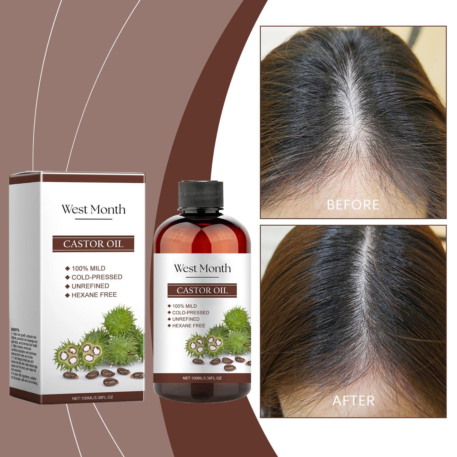 Xiyue All - in - one Castor Oil Is An Essential Oil For Multi - effect Care, Moisturizing Skin, Eyelashes And Eyebrows - 5 - CJ