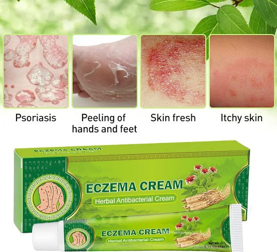 Sumifun - Eczema Skin Cream - 5 - CJ