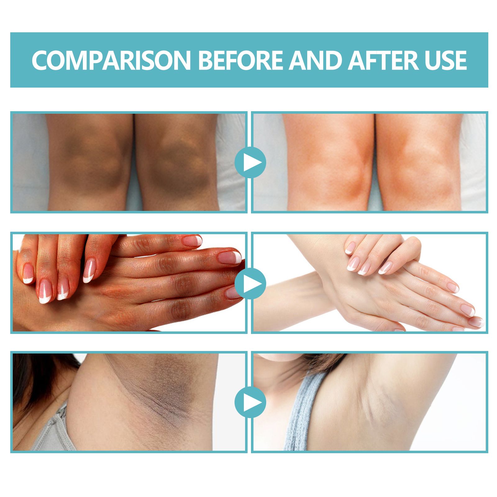 EELHOE Black Echinacea Repair Cream Repair Underarms Arms Knees Joints Dark Moisturizing Whitening Body Cream - 5 - CJ