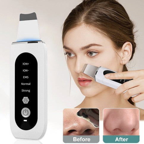 Shovel Skin Blackhead Ultrasonic Beauty Microcurrent Color Light - 5 - CJ