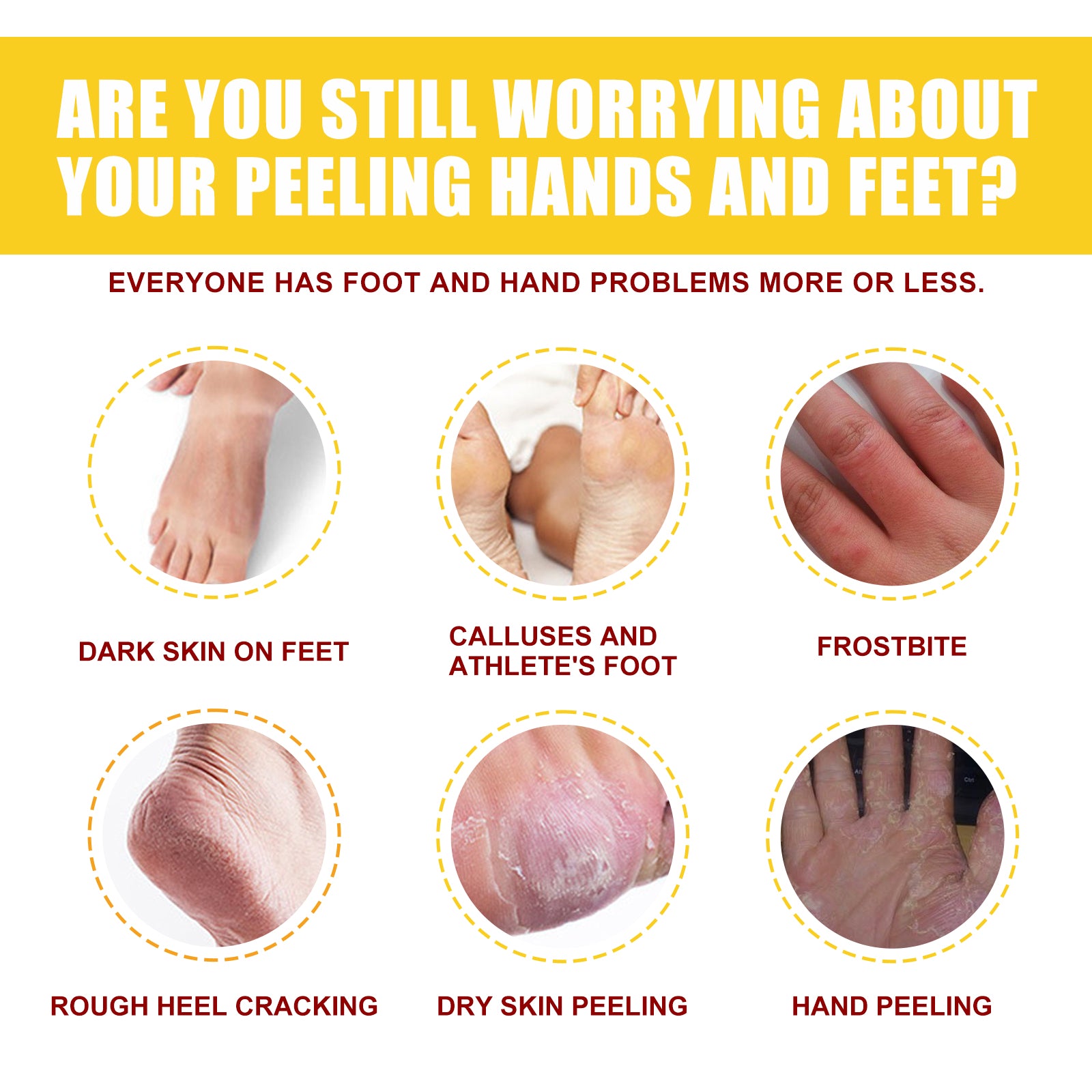 EELHOE Horse Oil Hand And Foot Repair Cream, Chapped Skin Care Moisturizing And Anti - Peeling Repair Cream - 5 - CJ
