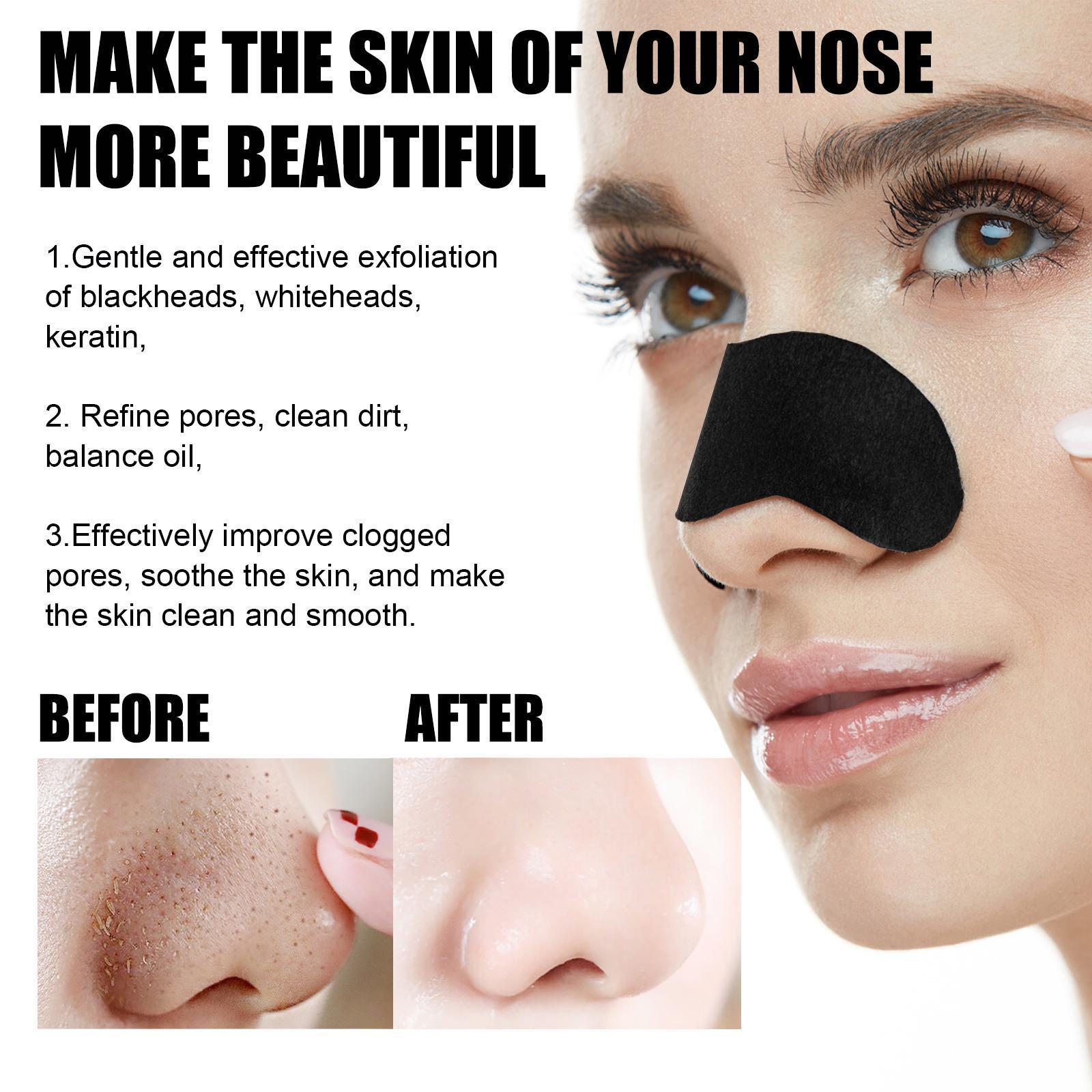 10 Pcs Blackhead Nose Patch Nose Pore Cleansing Strips Deep Cleansing Blackhead Remover Strips For Women Men - 5 - CJ