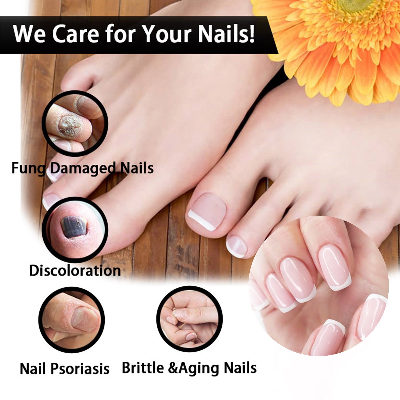 EELHOE Nail Repair Solution Thickening And Shining Nail Removal Dead Skin Repairing And Moisturizing Nail Nutritional Care Liquid - 5 - CJ