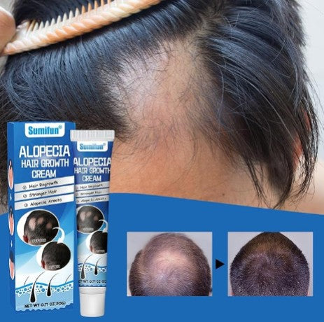 Hair Growth Cream - 5 - CJ
