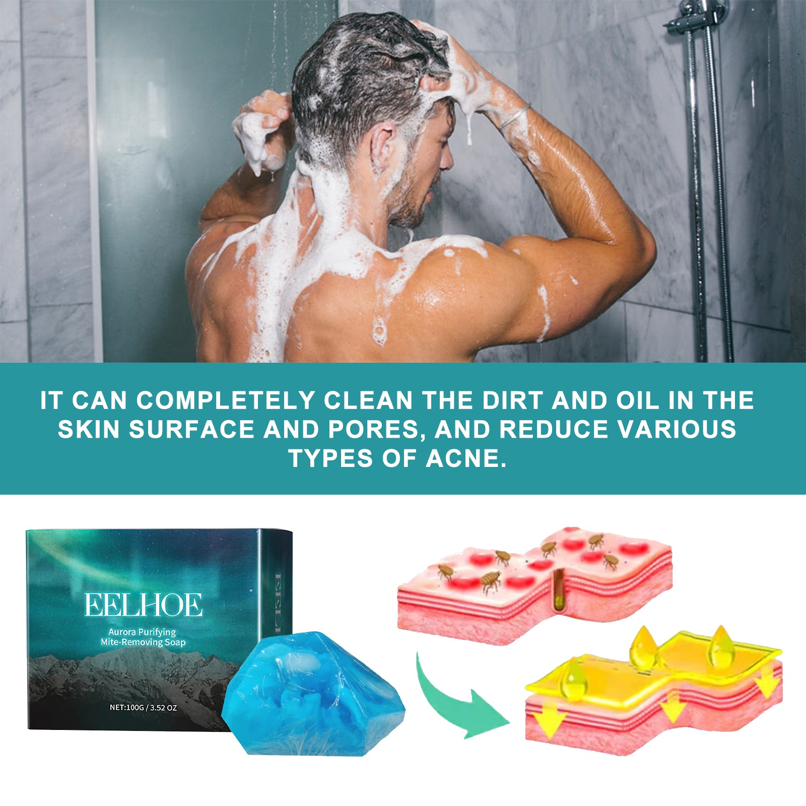 EELHOE Aurora Purifying Mite - Removing Soap, Deep Cleansing Facial Body Skin Fade Acne Print Multi - Effect Cleansing Soap - 5 - CJ