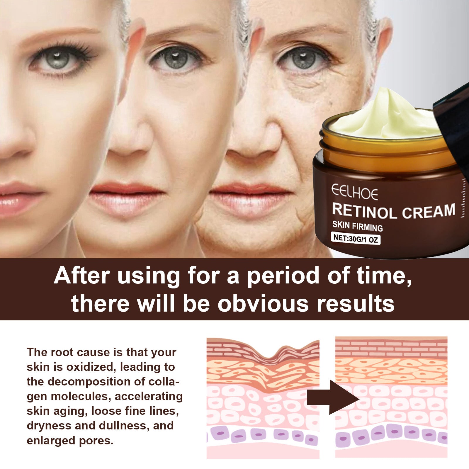 EELHOE Retinol Cream - 5 - CJ