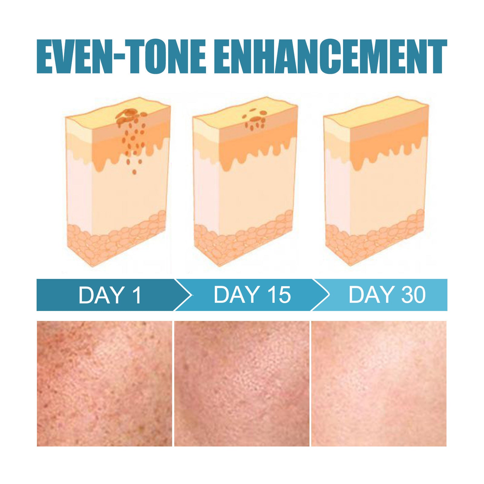 West&Month Skin Care Bar Armpit Joint Elbow Dark Skin Moisturizing Care Hydrating Moisturizing - 5.0 - CJ