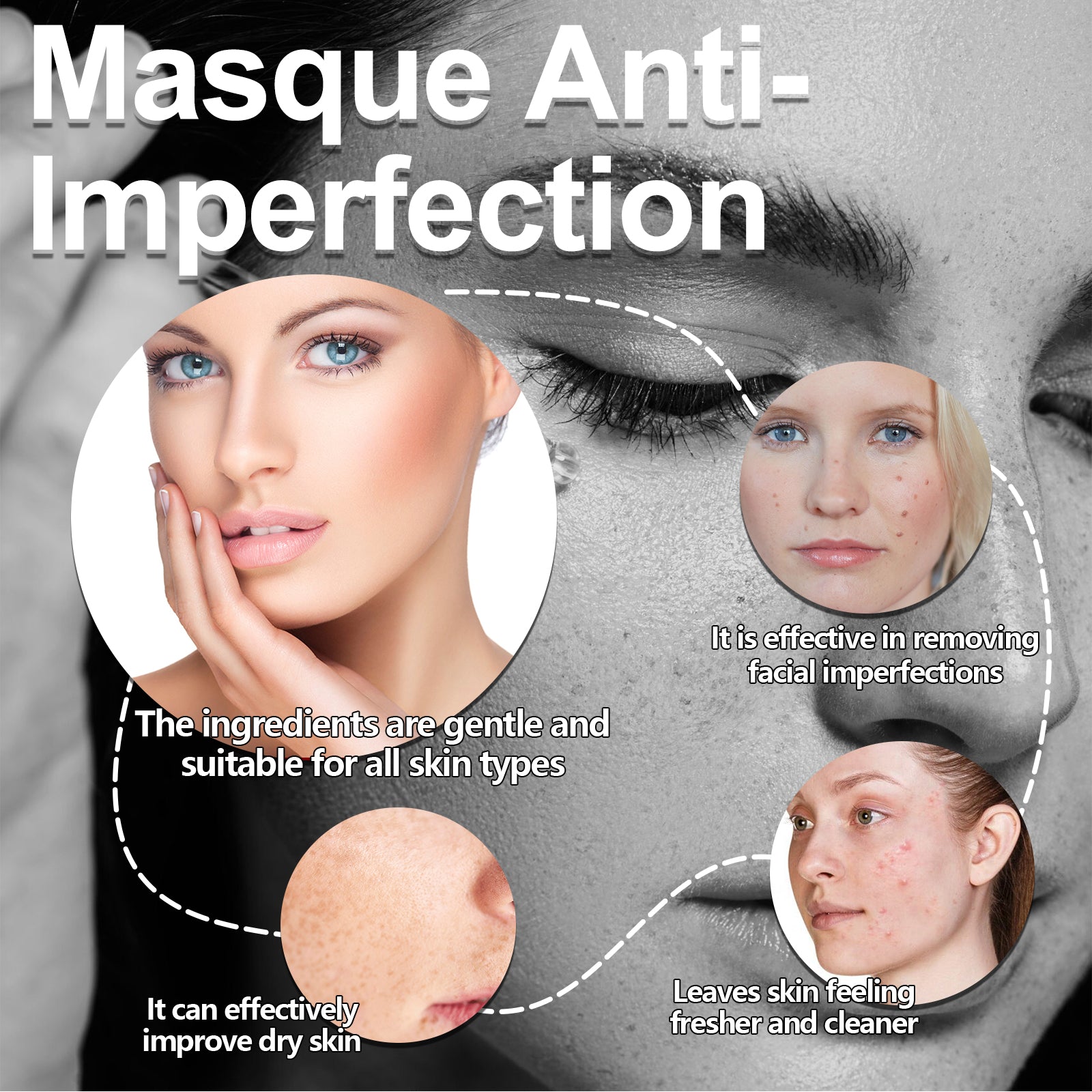 West Month Masque Anti - Imperfection, Clean And Repair Acne Seal Oil Control Solid Mask - 5 - CJ