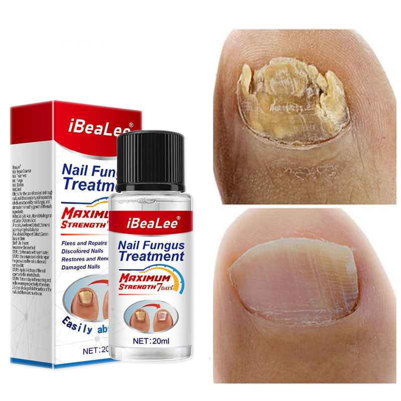Thickening Of Special Bacteriostatic Liquid For Onychomycosis - 0 - CJ - 20ML - CJJY158798101AZ