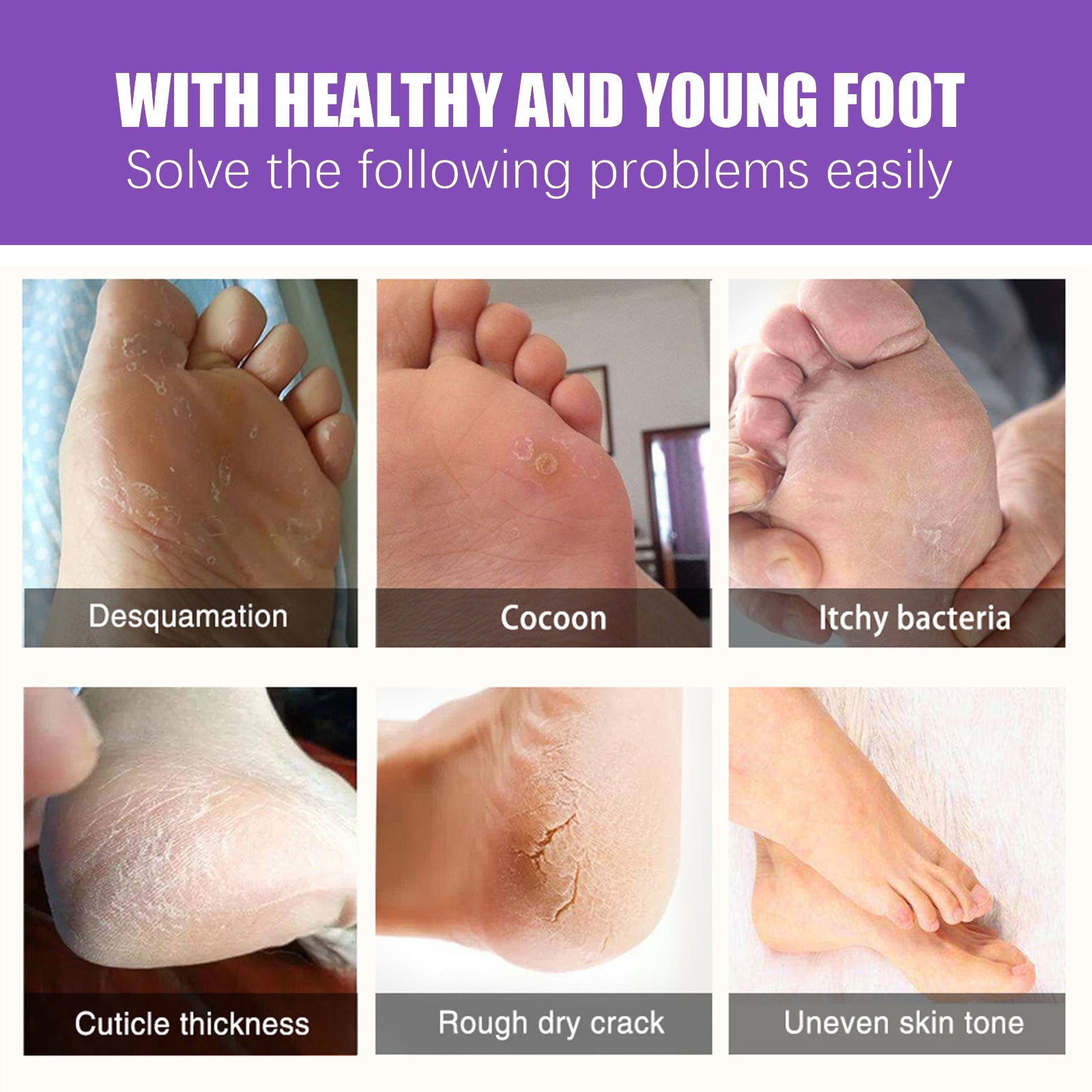 EELHOE Ginger Foot Mask (Bag) Foot Moisturizing, Nourishing, Rejuvenating, Exfoliating, Removing Dead Skin, Dry And Cracked Skin Care Foot Mask - 5 - CJ