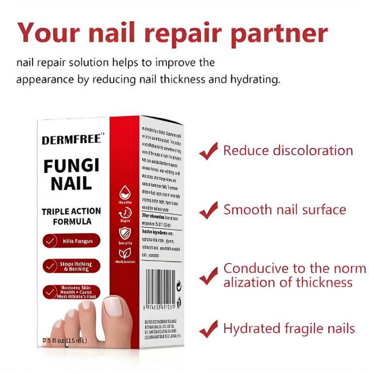 Whitenail Repair Liquid - Deep Penetrating Root Antibacterial Promotion For Healthy New Nail Growth - 5 - CJ