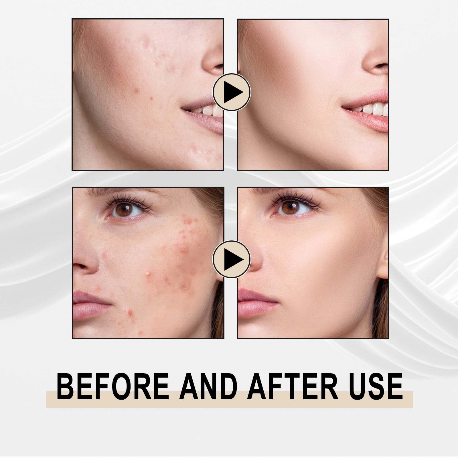 Jaysuing Lactobionic Acid Liquid Exfoliating Blackheads Shrinking Pores Cleansing Moisturizing Skin - 5 - CJ