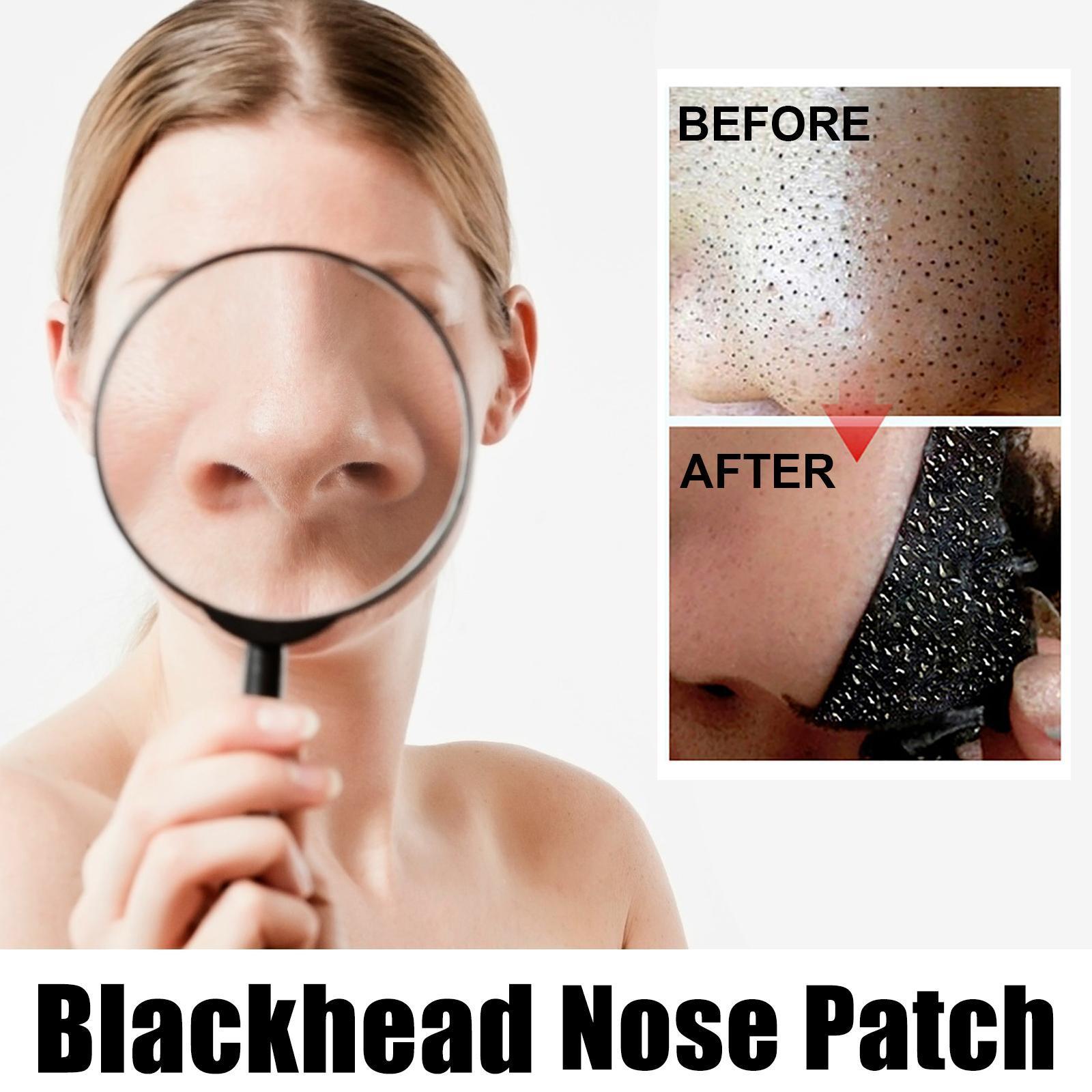 10 Pcs Blackhead Nose Patch Nose Pore Cleansing Strips Deep Cleansing Blackhead Remover Strips For Women Men - 5 - CJ