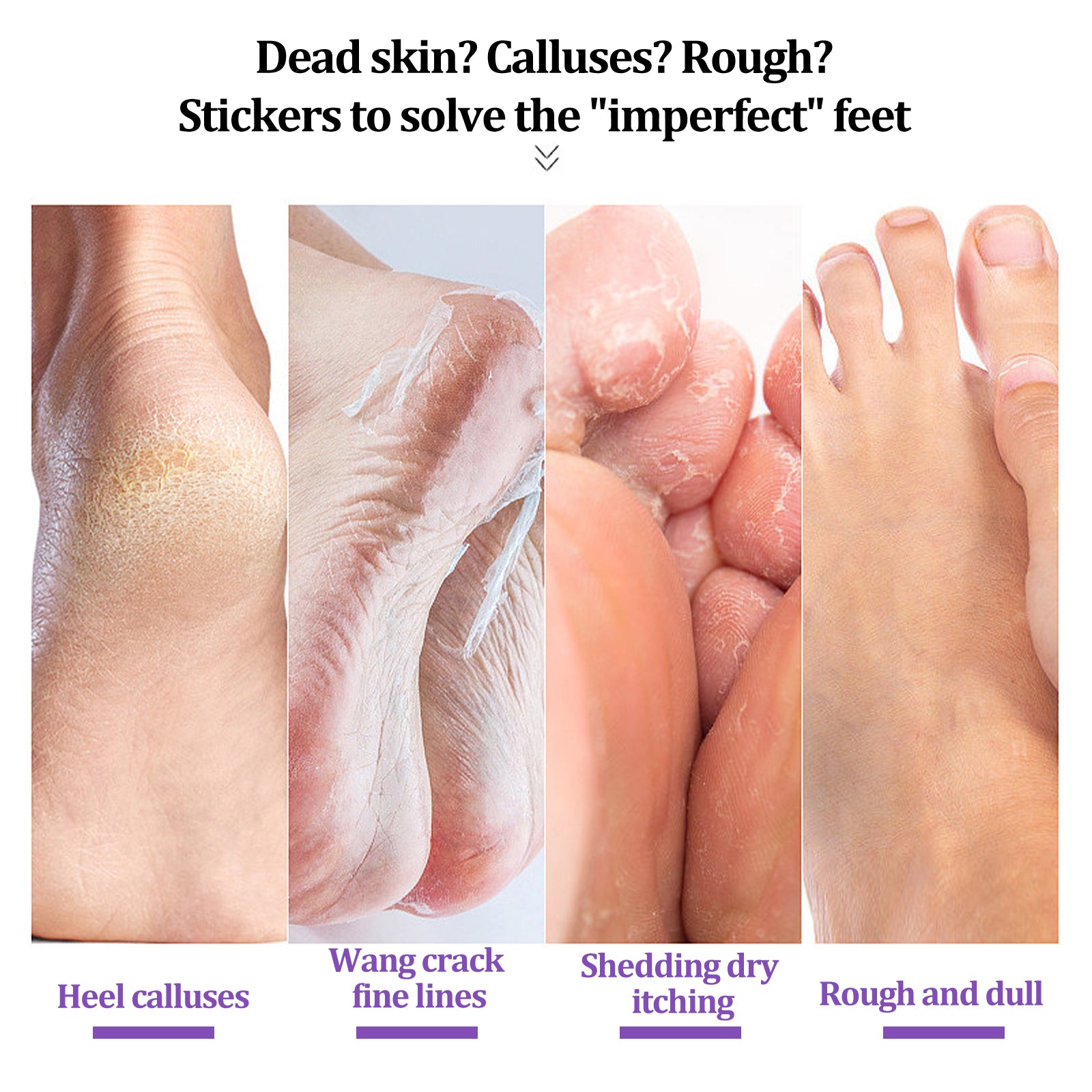 EELHOE Ginger Foot Mask (Bag) Foot Moisturizing, Nourishing, Rejuvenating, Exfoliating, Removing Dead Skin, Dry And Cracked Skin Care Foot Mask - 5 - CJ