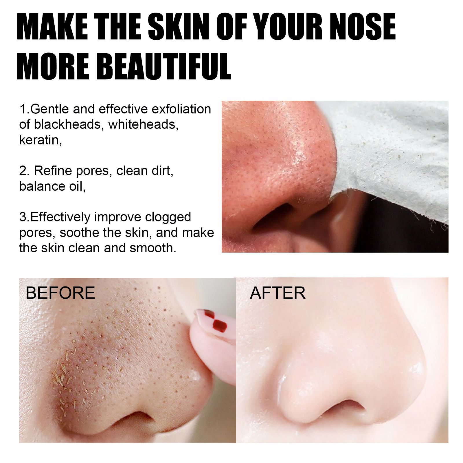 EELHOE Blackhead Removal Nasal Mask Deep Pore Cleansing Blackheads & Acne Rip - Off Nasal Mask - 5 - CJ