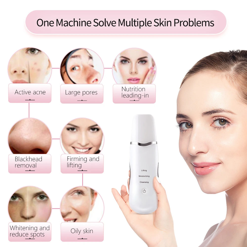 3 - in - 1 Ultrasonic Facial Spatula For Deep Cleansing, Electric Ultrasonic Skin Scrubber - 5 - CJ