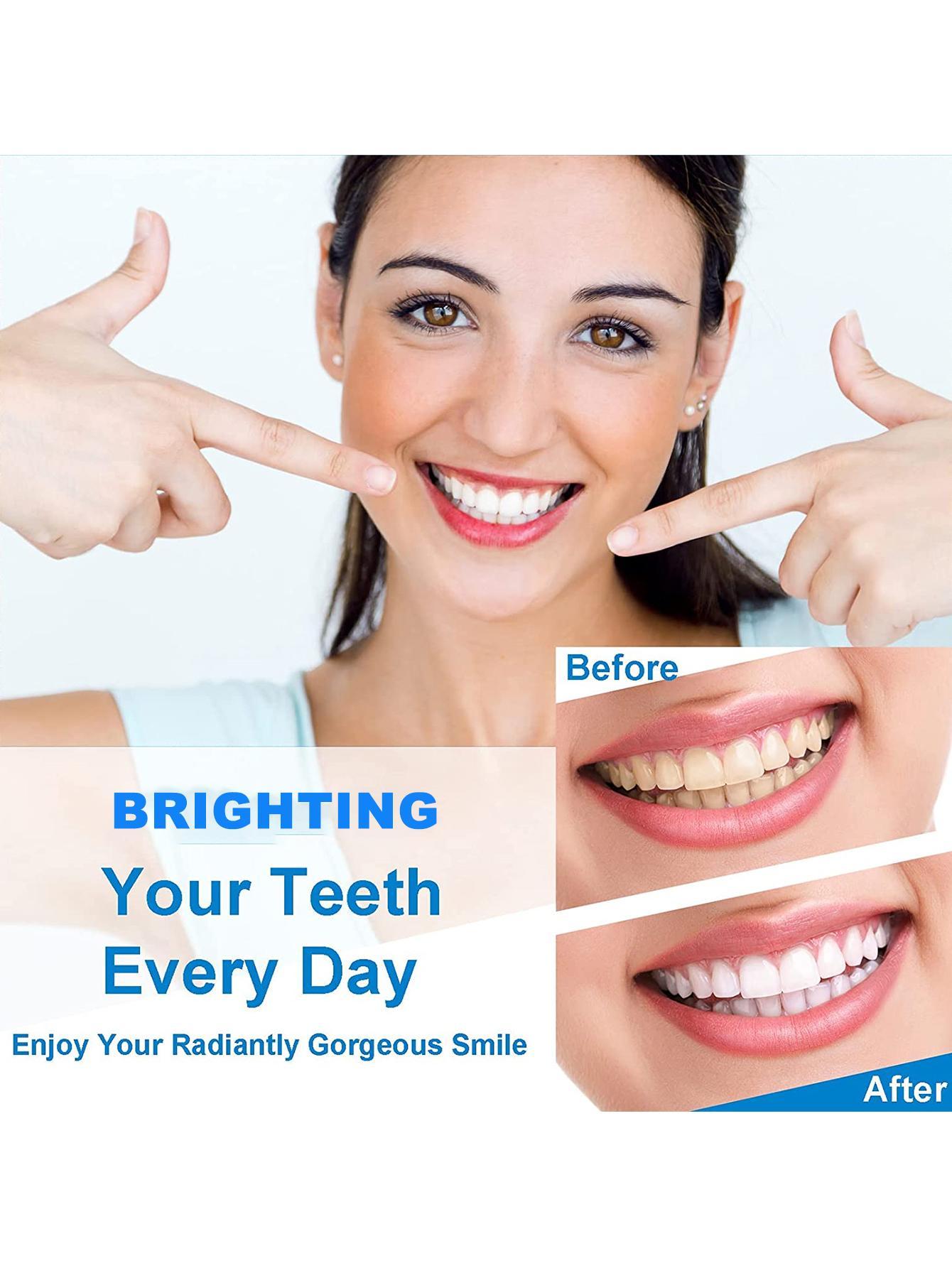 Teeth Whitening Strips 14 Treatments, 28 White Strips For Teeth Whitening, Reduced Sensitivity White Strips For Teeth Whitening - 5 - CJ