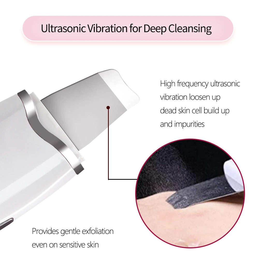 3 - in - 1 Ultrasonic Facial Spatula For Deep Cleansing, Electric Ultrasonic Skin Scrubber - 5 - CJ