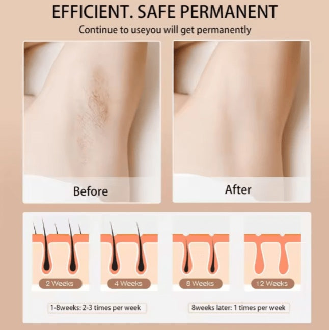 Babyverse - Digital IPL Hair Removal Device - 5 - CJ