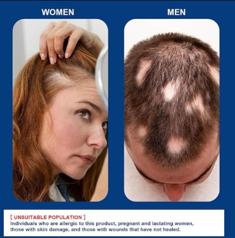 Hair Growth Cream - 5 - CJ