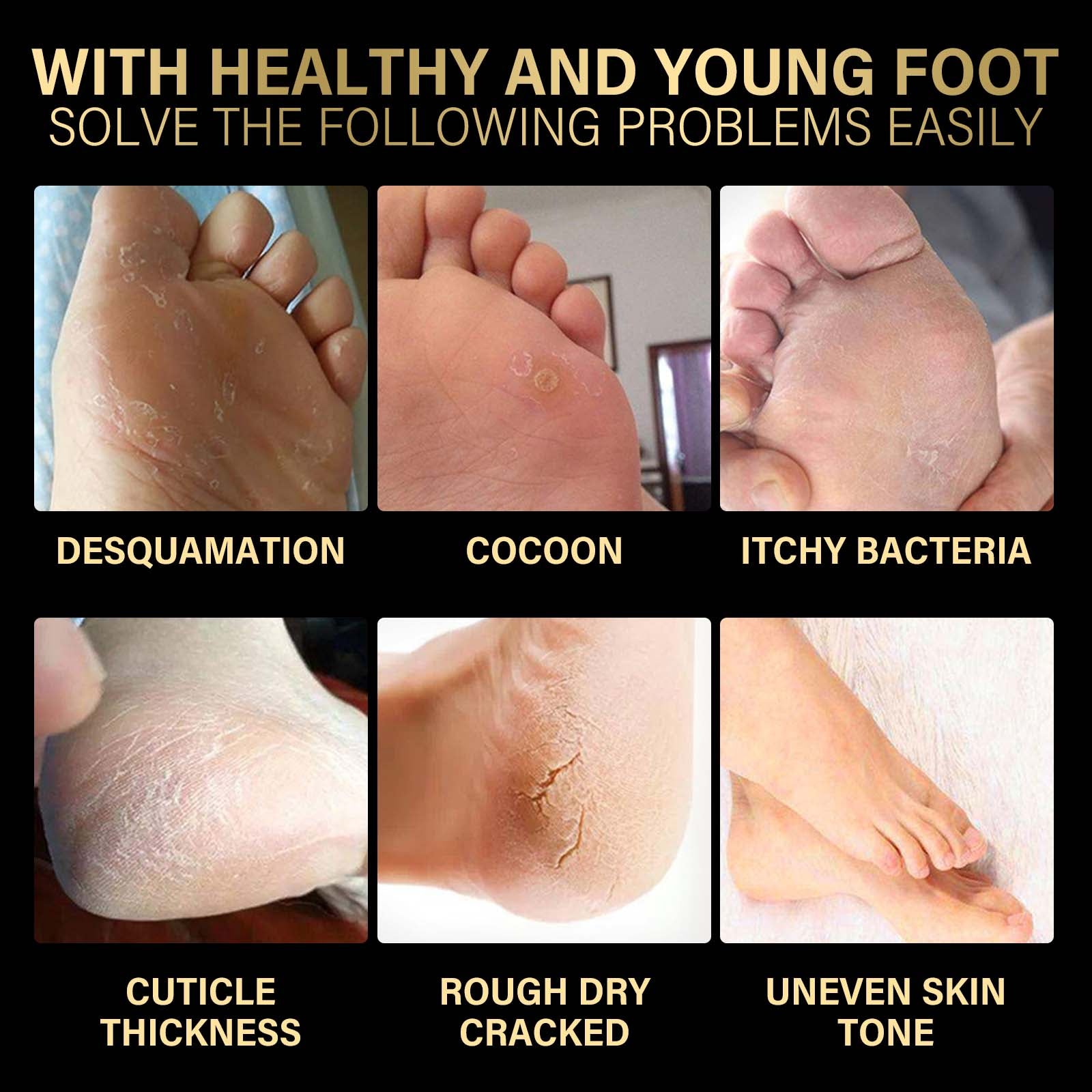 Jaysuing Lavender Exfoliating Foot Mask Exfoliating Foot Care Hydrating, Hydrating, Anti - chapping And Moisturizing Skin - 5 - CJ