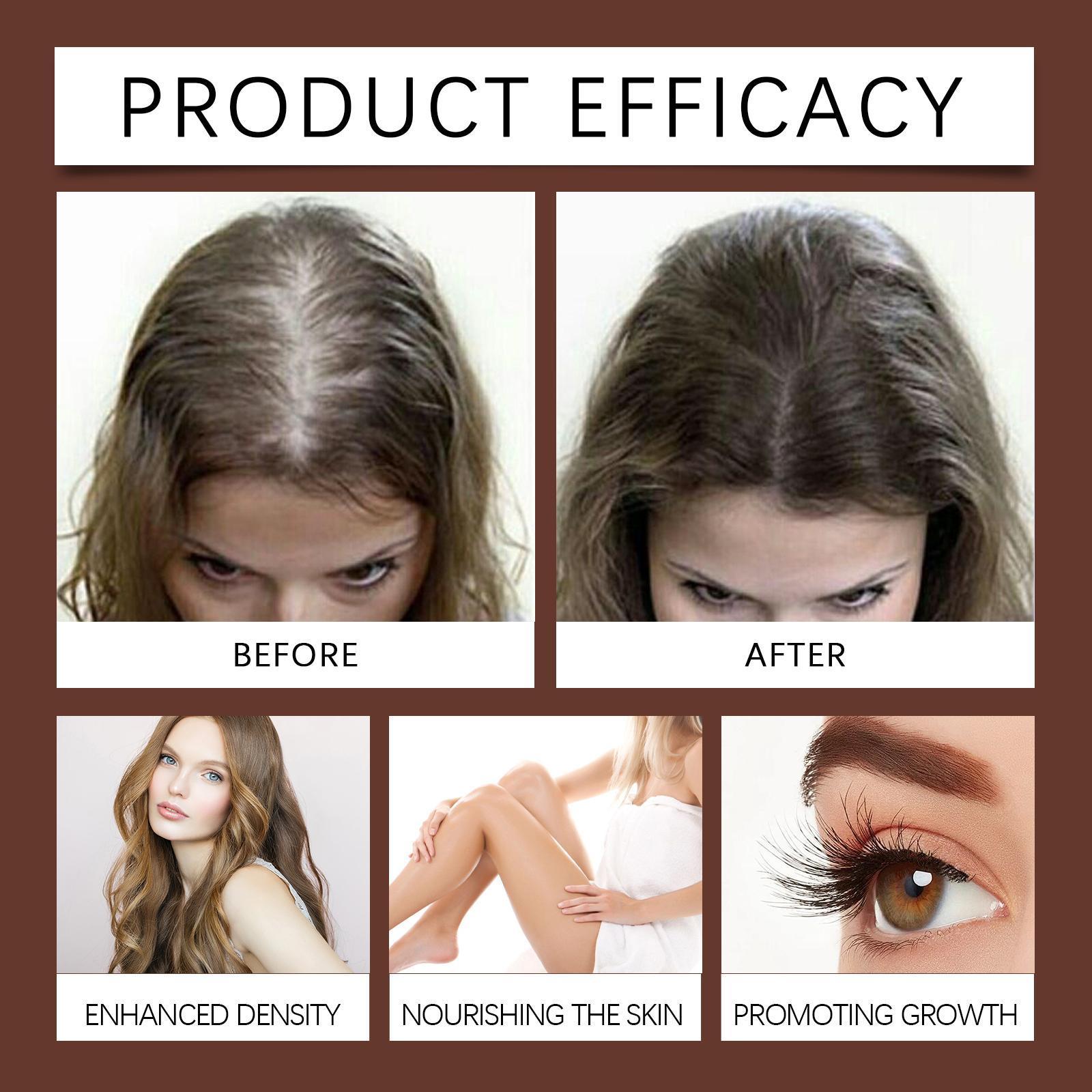Xiyue All - in - one Castor Oil Is An Essential Oil For Multi - effect Care, Moisturizing Skin, Eyelashes And Eyebrows - 5 - CJ