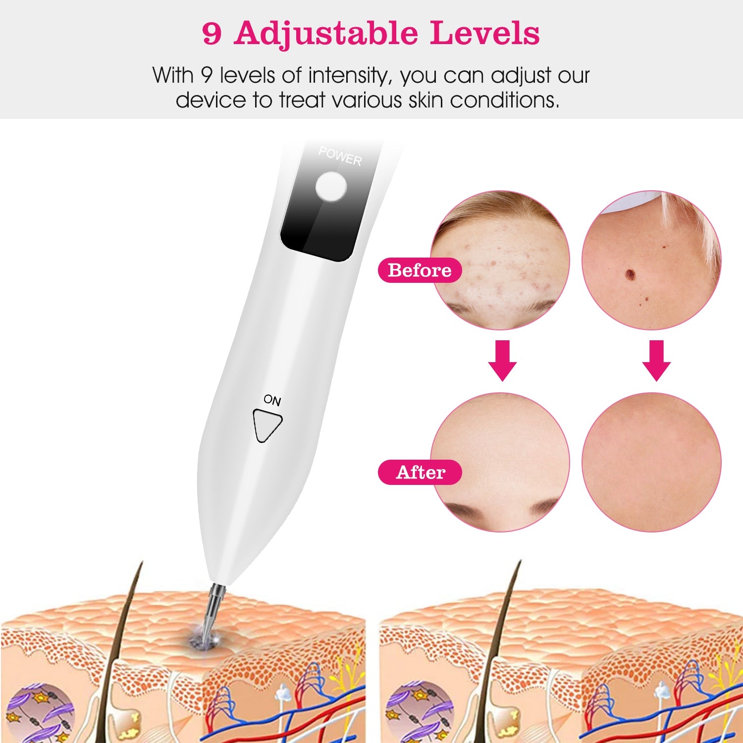 2 PCS Skin Rash Repair Kit - 5 - CJ