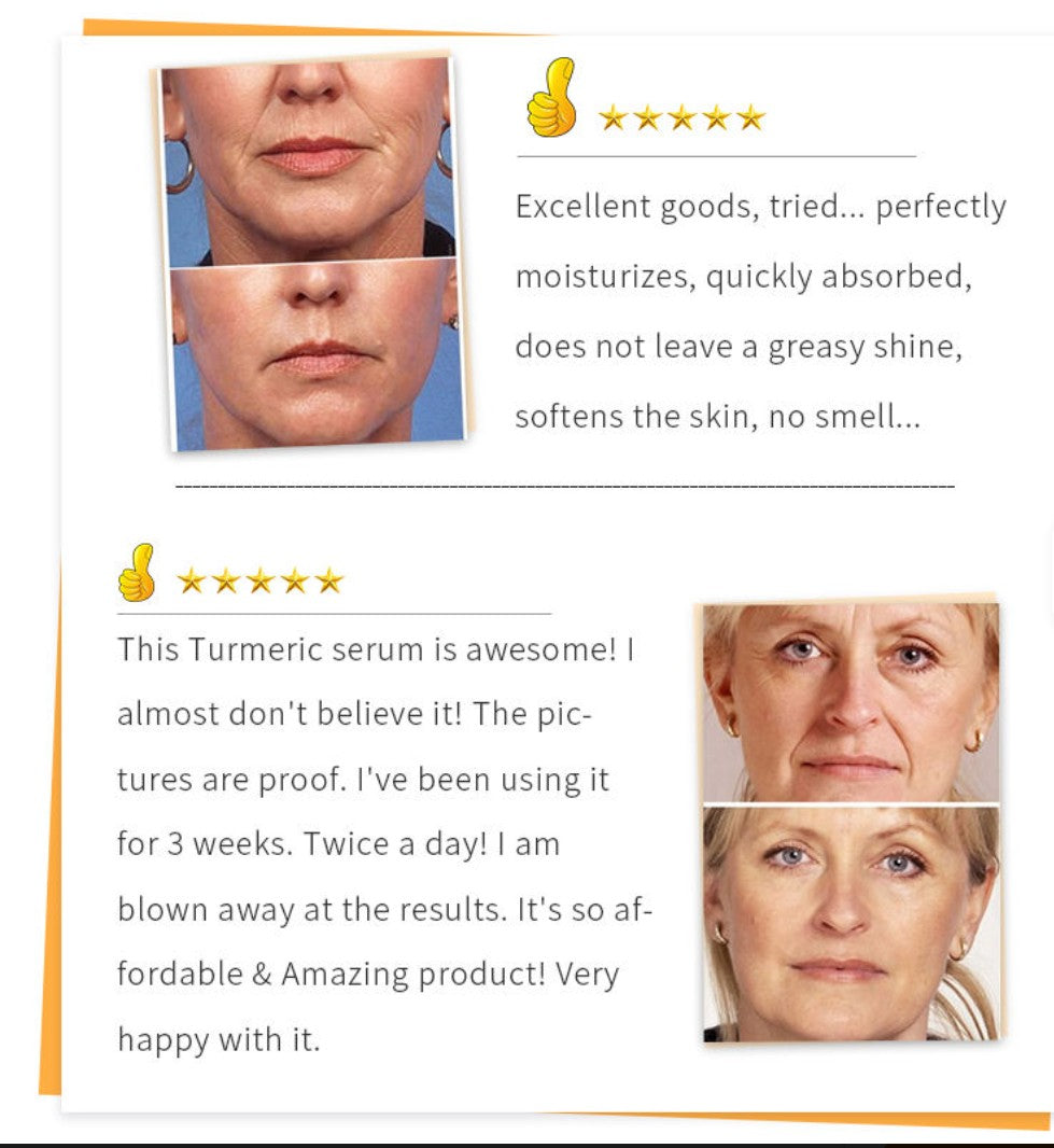 Beauty Lights Turmeric Serum - 5 - CJ