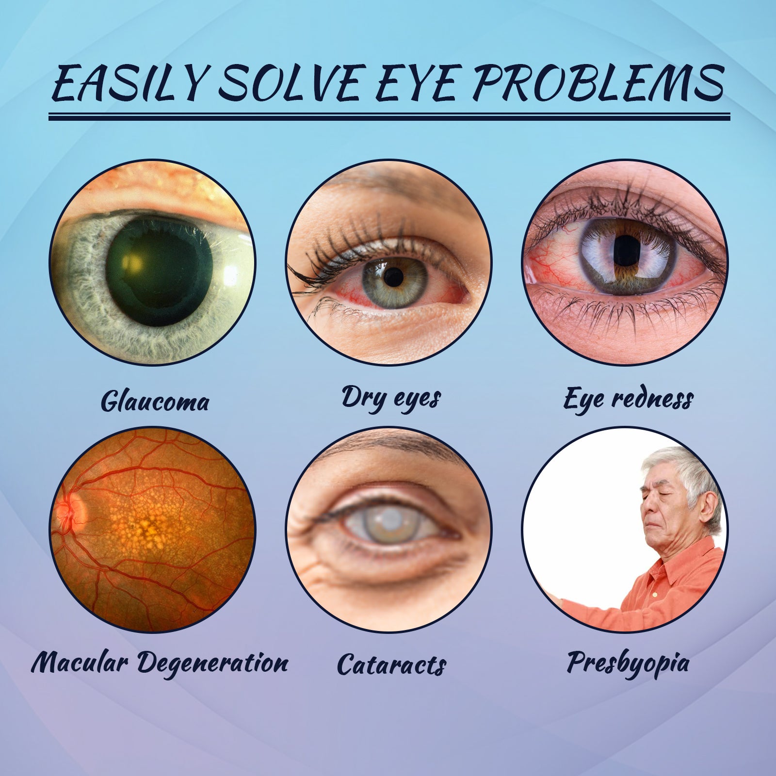 EELHOE Eye Drops Relieve Redness And Blurred Eyes Eye Fatigue Dryness Blurred Vision Moisturizing Eye Care Solution - 5 - CJ