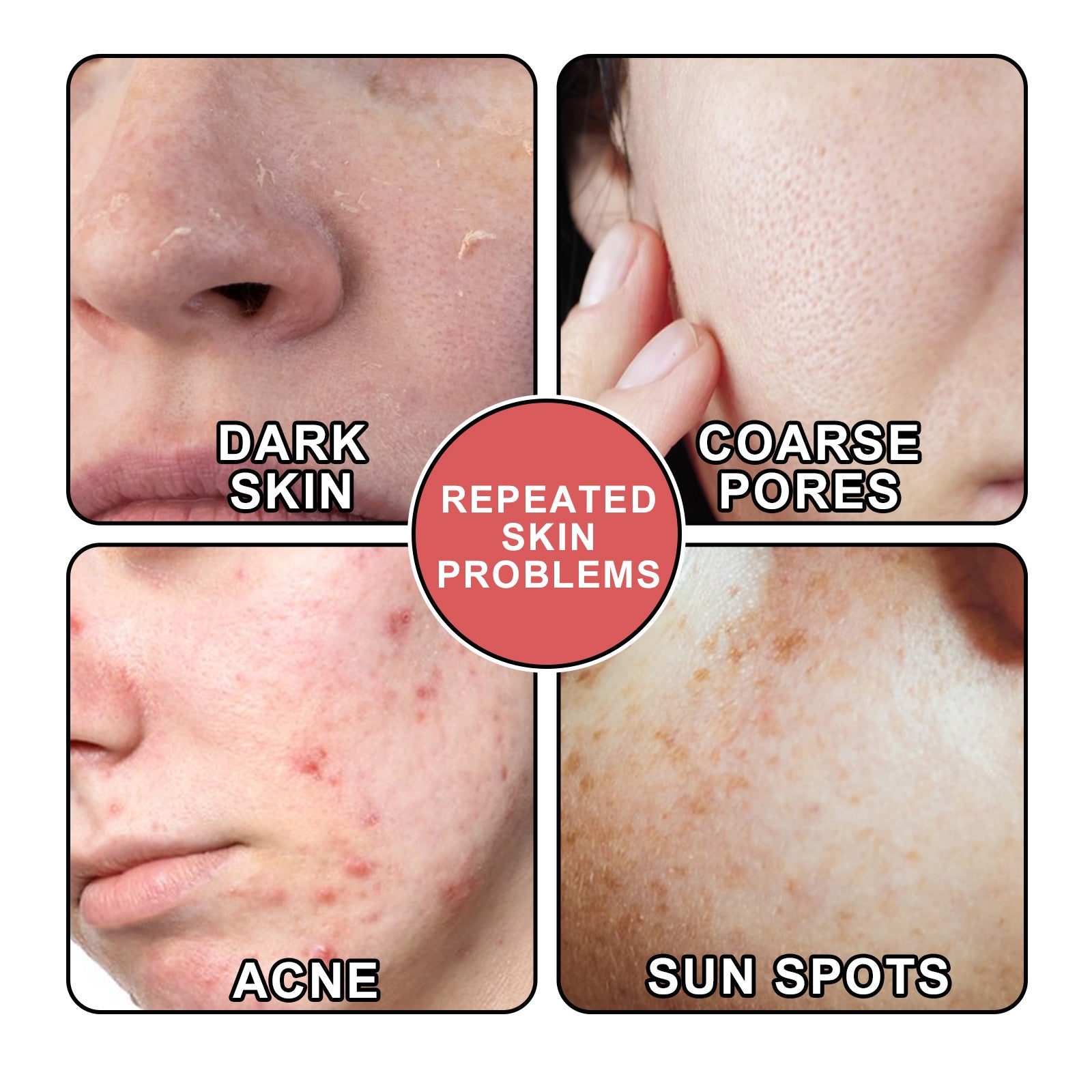 South Moon Nicotinamide Skin Care Essence Facial Skin Hydrating And Firming Skin Care Essence - 5 - CJ