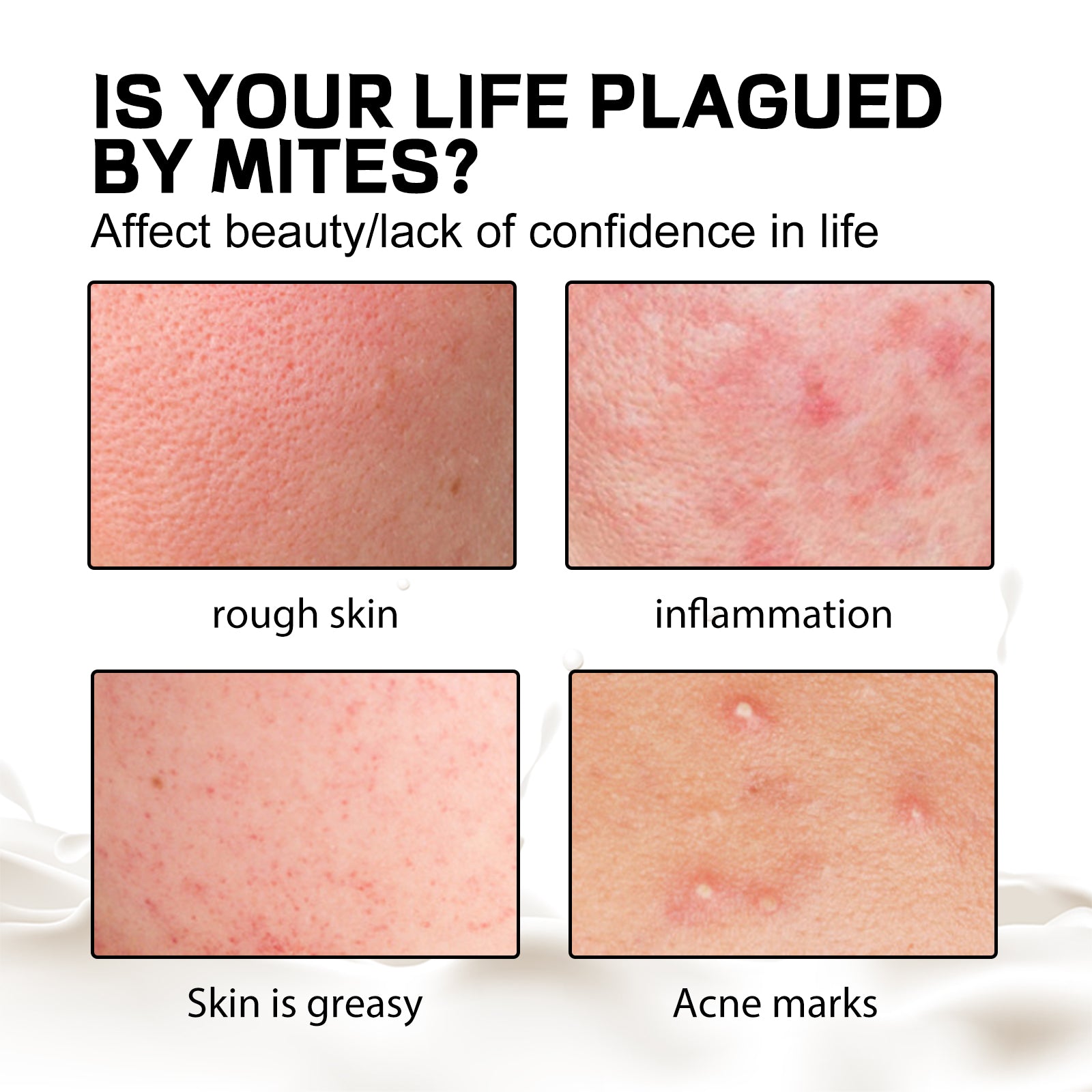 EELHOE Aurora Purifying Mite - Removing Soap, Deep Cleansing Facial Body Skin Fade Acne Print Multi - Effect Cleansing Soap - 5 - CJ