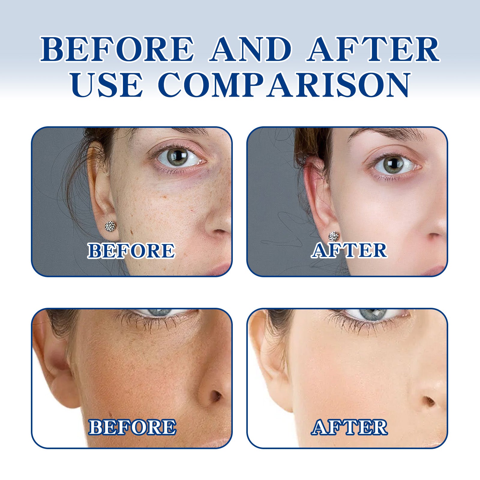 Ouhoe Brightening Cream Brightening Complexion Lightening Facial Spots Hydrating Moisturizing Firming And Tender Skin Cream - 5 - CJ