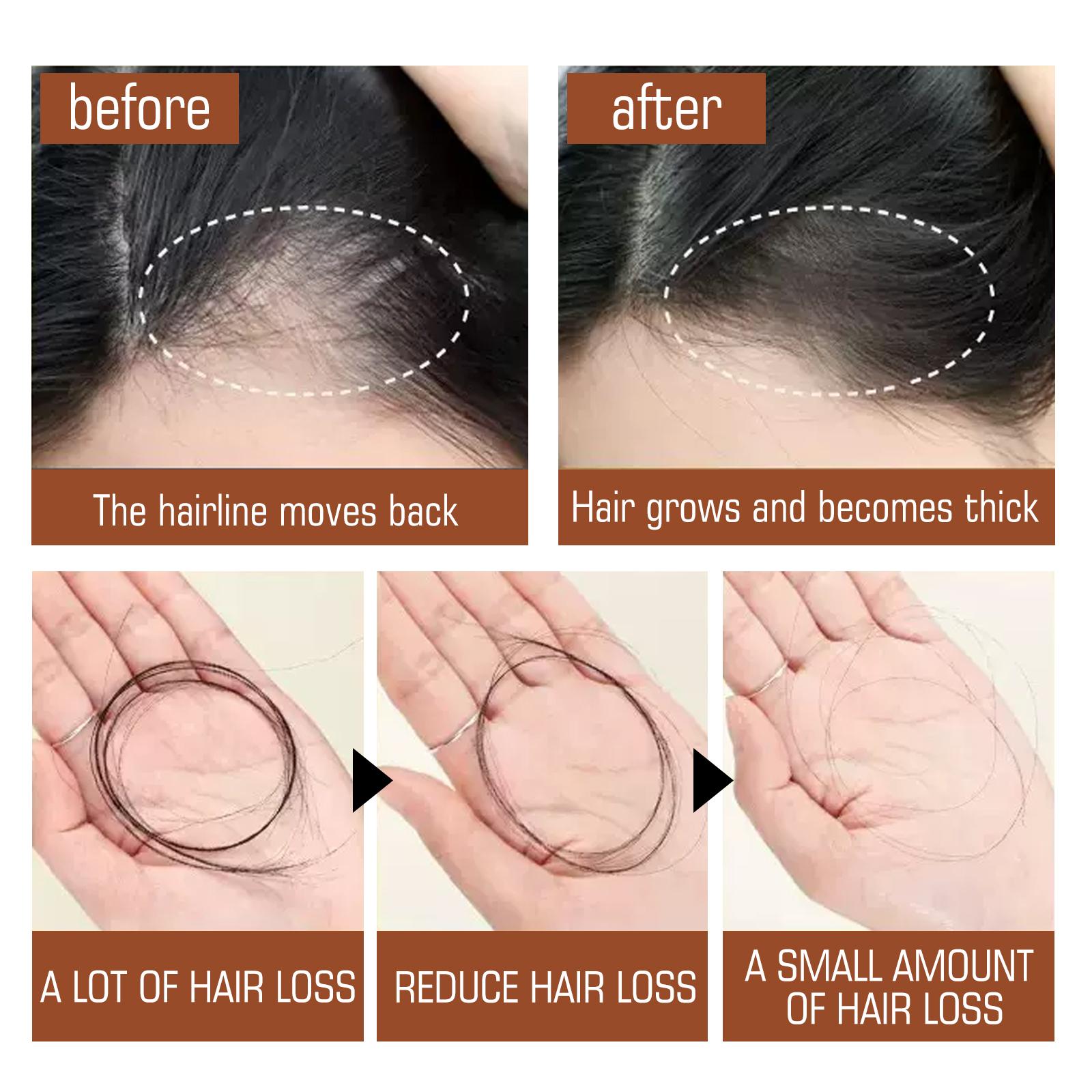 Batana Oil From Honduras - Get Fuller, Thicker, Healthier Hair - Great Gifts For Women Men Conditioner Haircare Silky - Hair Nutrition - 5 - CJ
