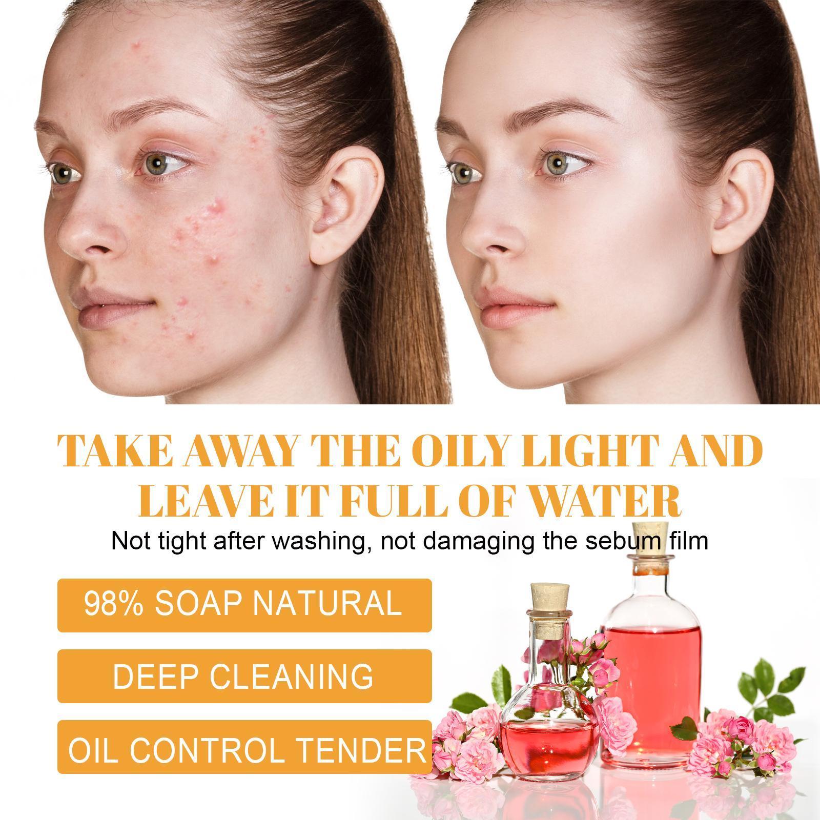 Hoijji Brightening Facial Cleanser, Deep Cleansing Facial Skin, Fades Acne Marks, Moisturizes And Whitens - 5 - CJ