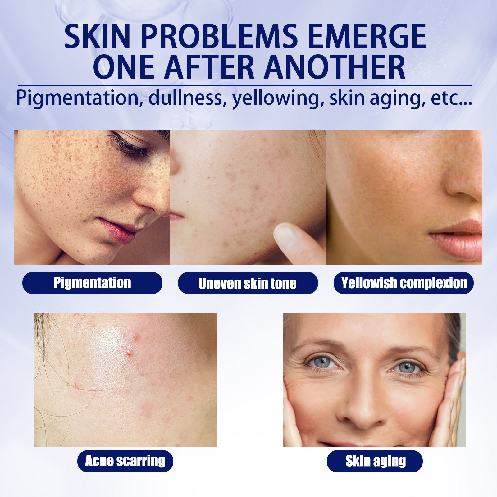 EELHOE Anti - aging Vitamin C Facial Essence, Reduces Spots Acne Fine Lines, Moisturizes Facial Essence - 5 - CJ