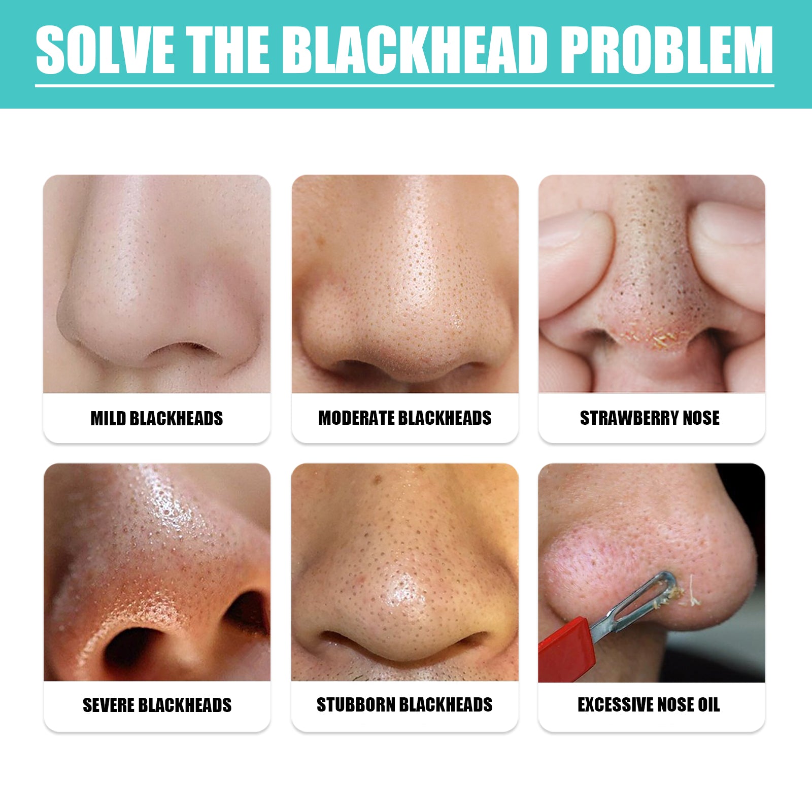 EELHOE Blackhead Nose Mask Moisturizes And Smoothes The Skin, Removes Blackheads From Acne And Deeply Cleans Pores And Dirt - 5 - CJ