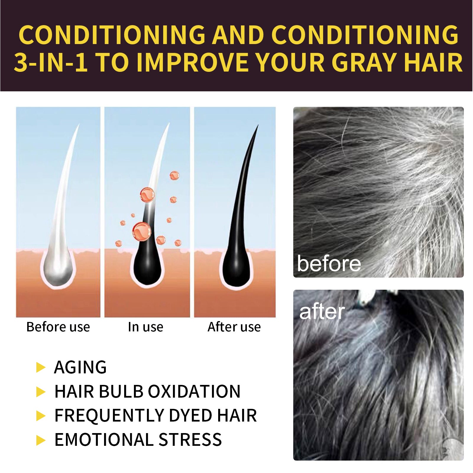 Removing Dandruff And Black Hair Shampoo Black - 5 - CJ