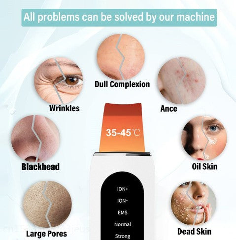 Shovel Skin Blackhead Ultrasonic Beauty Microcurrent Color Light - 5 - CJ
