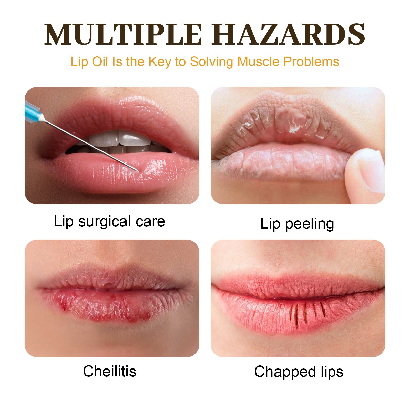 EELHOE Honey Lip Oil, Reduces Lip Lines, Prevents Cracking And Peeling, Moisturizing Lip Care Oil. - 5.0 - CJ