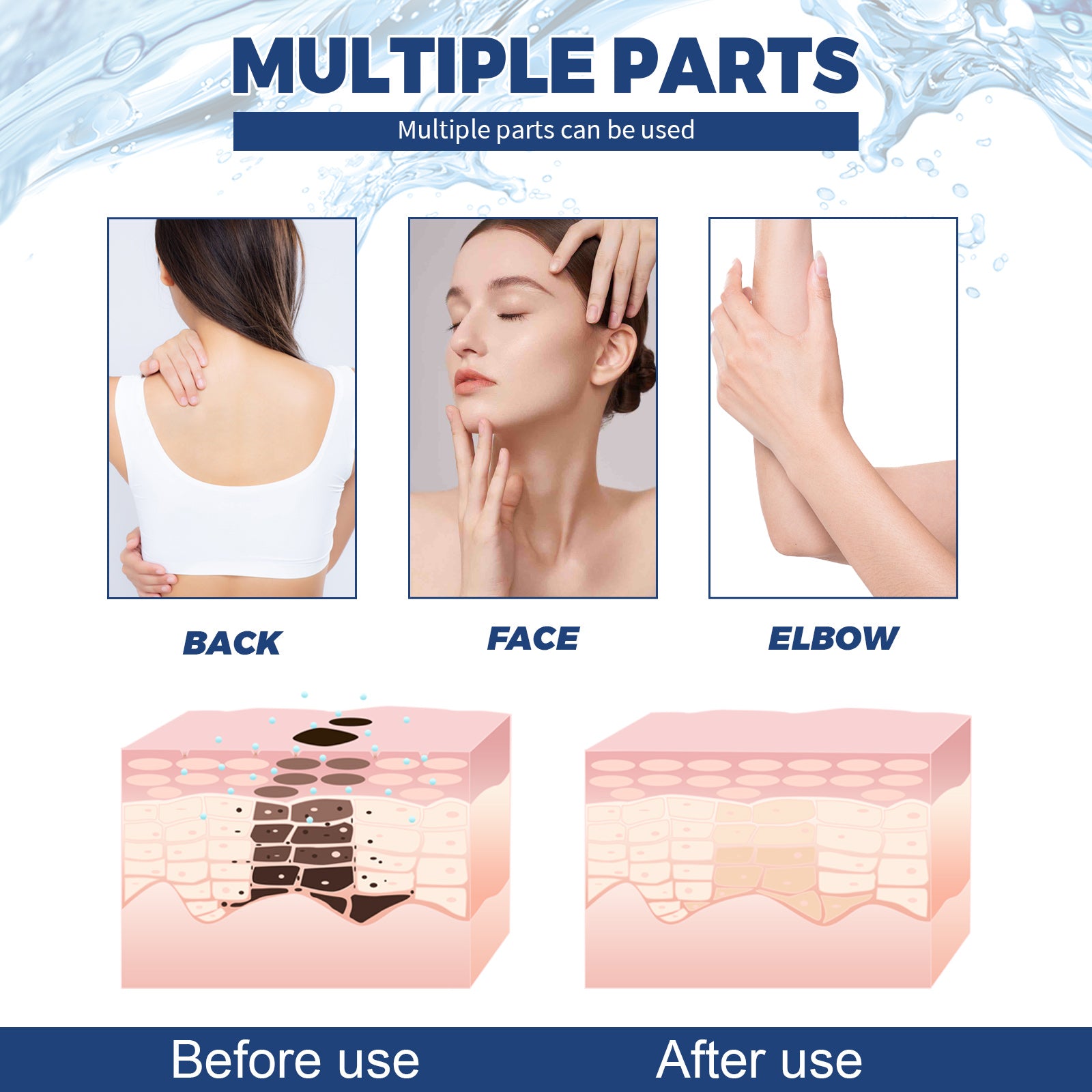 Jaysuing Spot Body Cleanser, Face Body Cleansing Skin Fade Spot Whitening Beauty Skin Cream - 5 - CJ