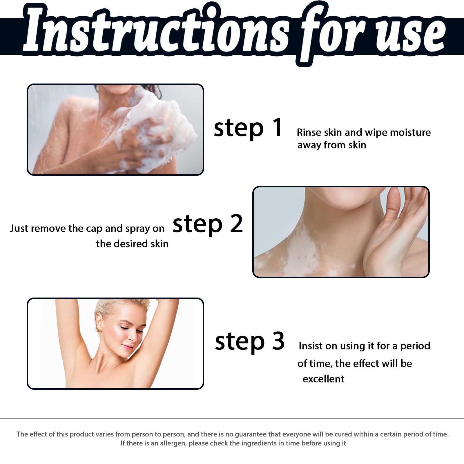 South Moon White Spot Clear Spray Tonic Topical Skin Repair Flower Spot Solution Treatment White Spot Clear Spray - 5 - CJ