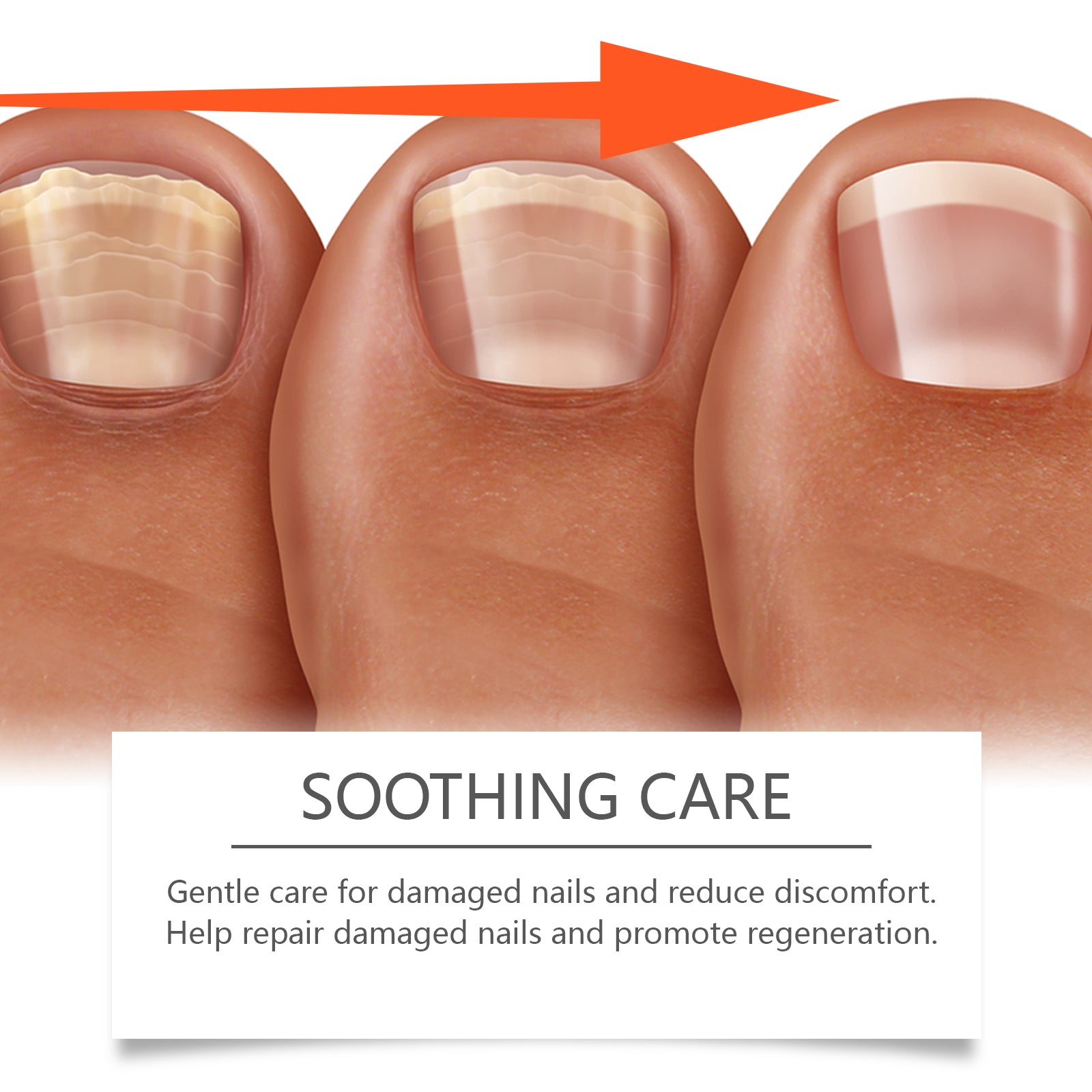 Ximonth Herbal Nail Care Solution Hand, Foot And Nail Cleansing And Repair Bright Nail Thick Toe Care Solution - 5 - CJ