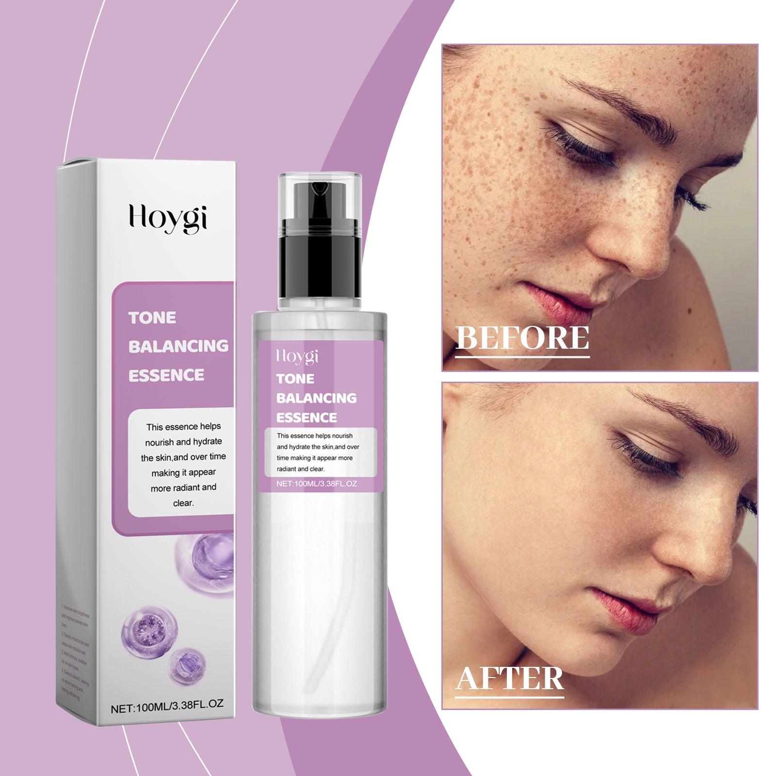 Hoygi Tone Balancing Essence, Desalination Moisturizing Facial Spots Moist Shine Bright Skin Essence - 5 - CJ
