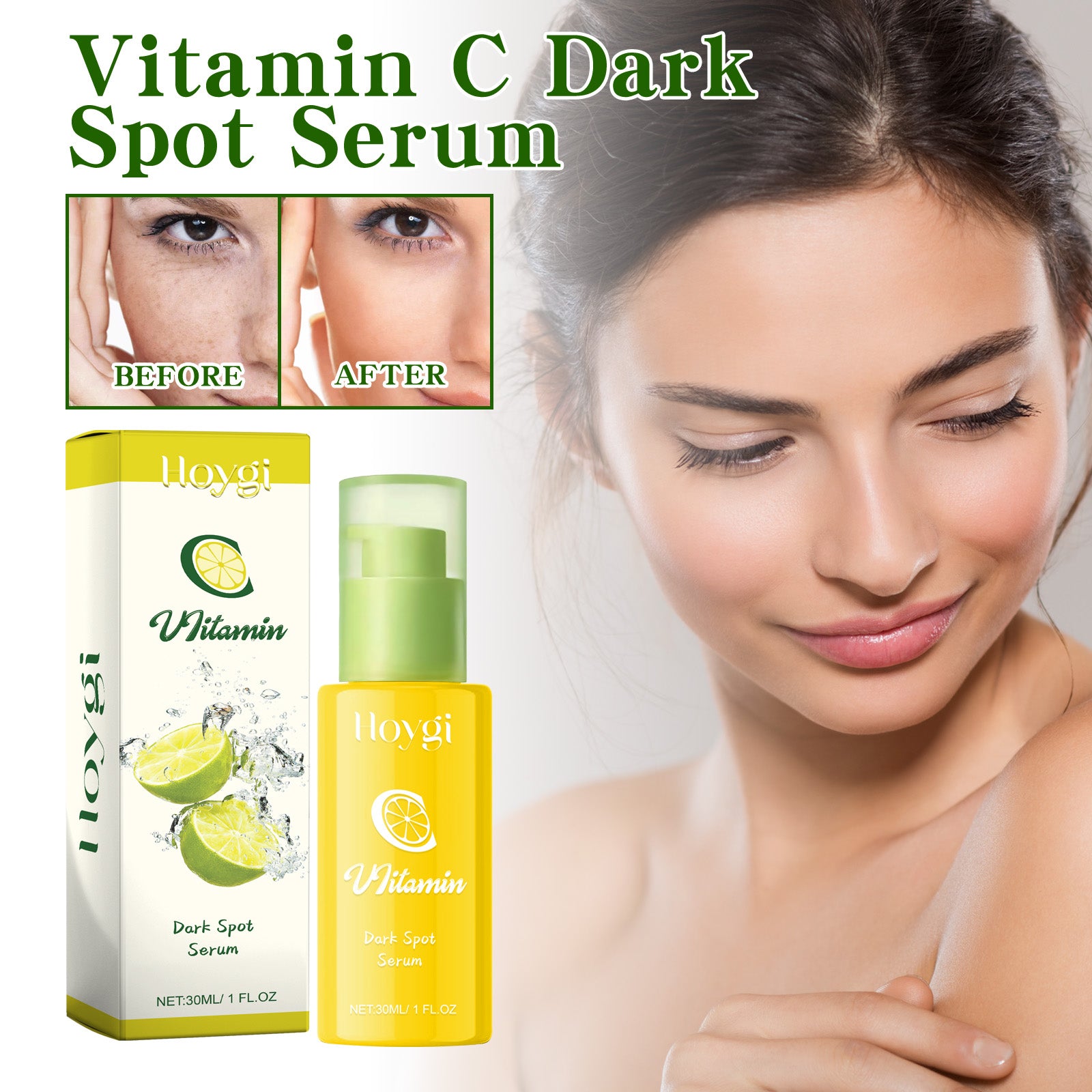 Hoygi Anti - Wrinkle Serum, Fade Spots And Fine Lines With Line Firming And Moisturizing Moisturizing Anti - Wrinkle Essence - 5 - CJ